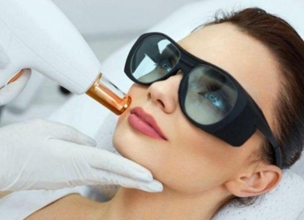 întinerirea facială a pielii pielii